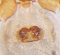 Epigyne
