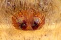 Epigyne