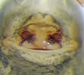 Epigyne