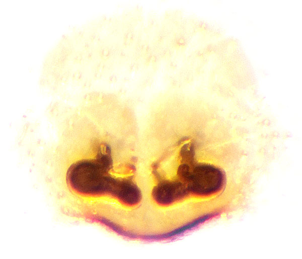 Datei:Icius subinermis Vulva.jpg