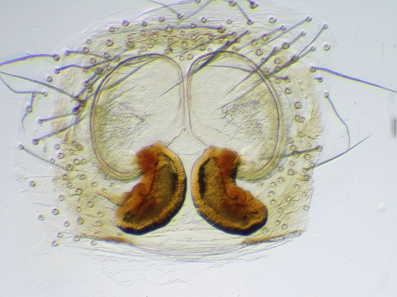 Datei:Pseudeuophrys erratica Vulva.jpg