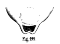 Datei:KochClubionaHolosericea.jpg