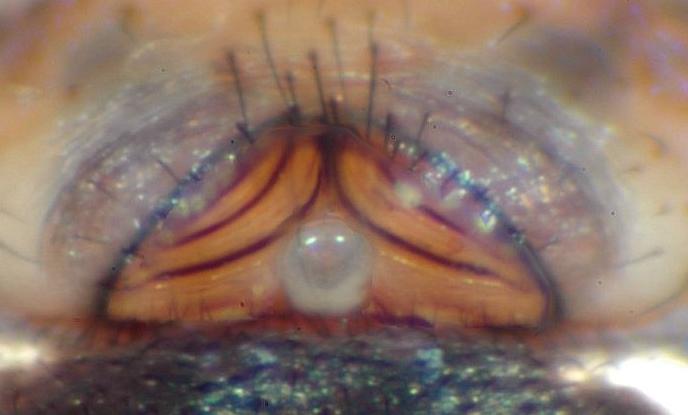 Datei:Linyphia triangularis epigyne.jpg