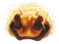 Vulva (präpariert)