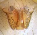 Epigyne