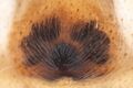 Epigyne