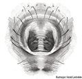 Epigyne