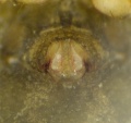 Epigyne